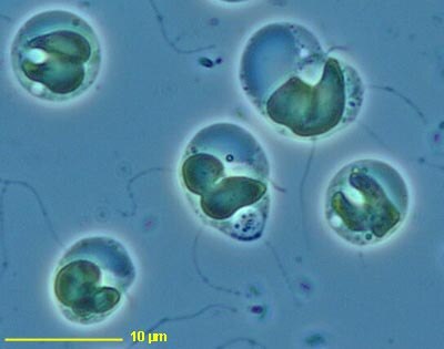 CCMP1857 | NCMA at Bigelow Laboratory